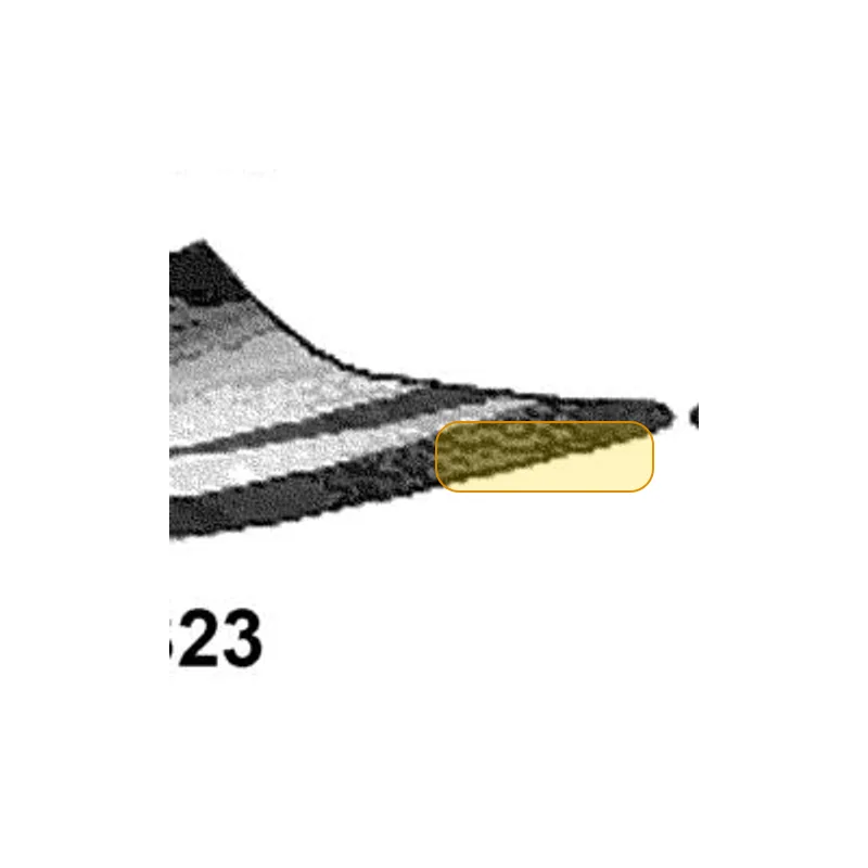 86241-ALG1-E10-T02 STRIPE B R BODY COVER — diagram cutout